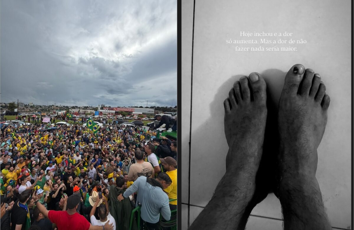 Nikolas Ferreira exibe pés feridos após marcha até Brasília